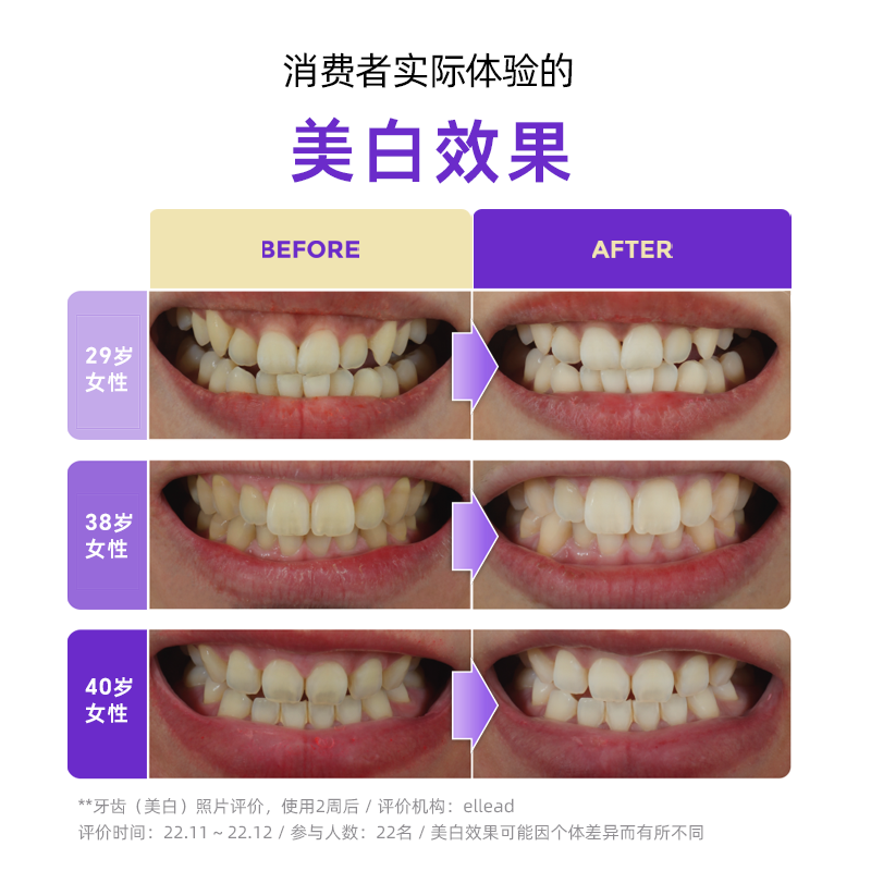 LG官方正品竹盐喜马拉雅 粉盐 紫色色修亮白牙膏清新口气100g,淘宝优惠券,粉丝福利购,淘宝优惠卷
