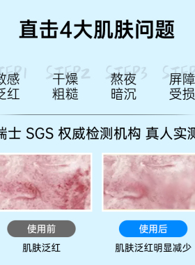 日本版娥佩兰薏仁水湿敷爽肤水