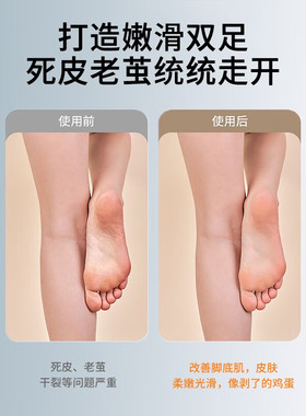松下去死皮除老茧电动磨脚器