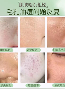 【买一送三同款 多买多送】修正寡肽精华液烟酰胺补水提亮肤色