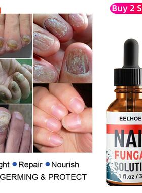 RepairSerumNailRemovalGel