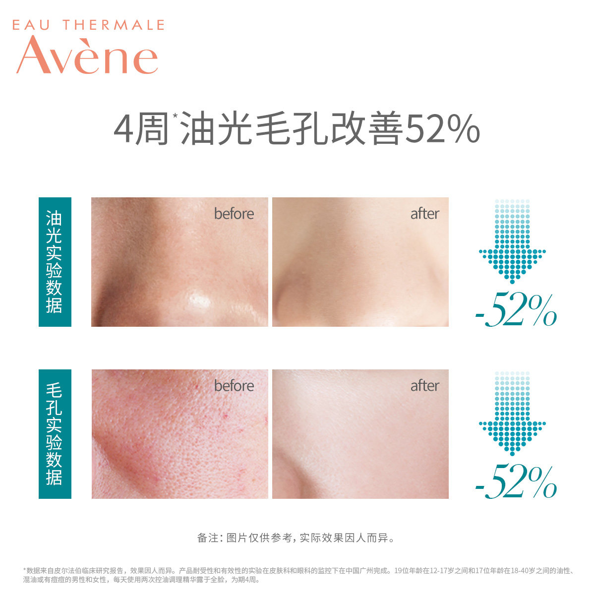 【欢聚日抢先加购】雅漾控油精华露 雅漾液态精华