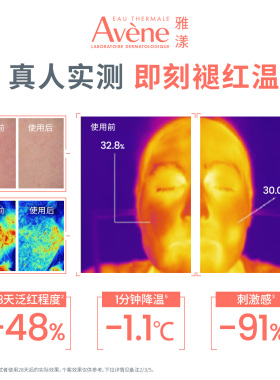 【双11现货速达】雅漾专研特护修红精华乳舒缓褪泛红修护乳液