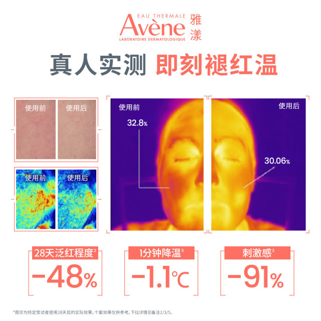 Avène ມີຄວາມຊ່ຽວຊານໃນການສ້ອມແປງເຊລັ່ມແກ້ມຮອຍແດງ ແລະ ໂລຊັນແກ້ຮອຍແດງ