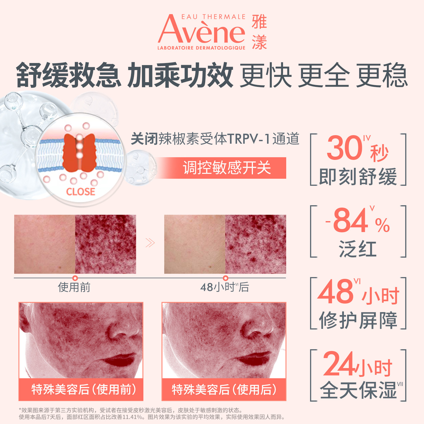 【樊振东同款】雅漾专研修护霜舒缓褪泛红敏感肌补水保湿维稳面霜