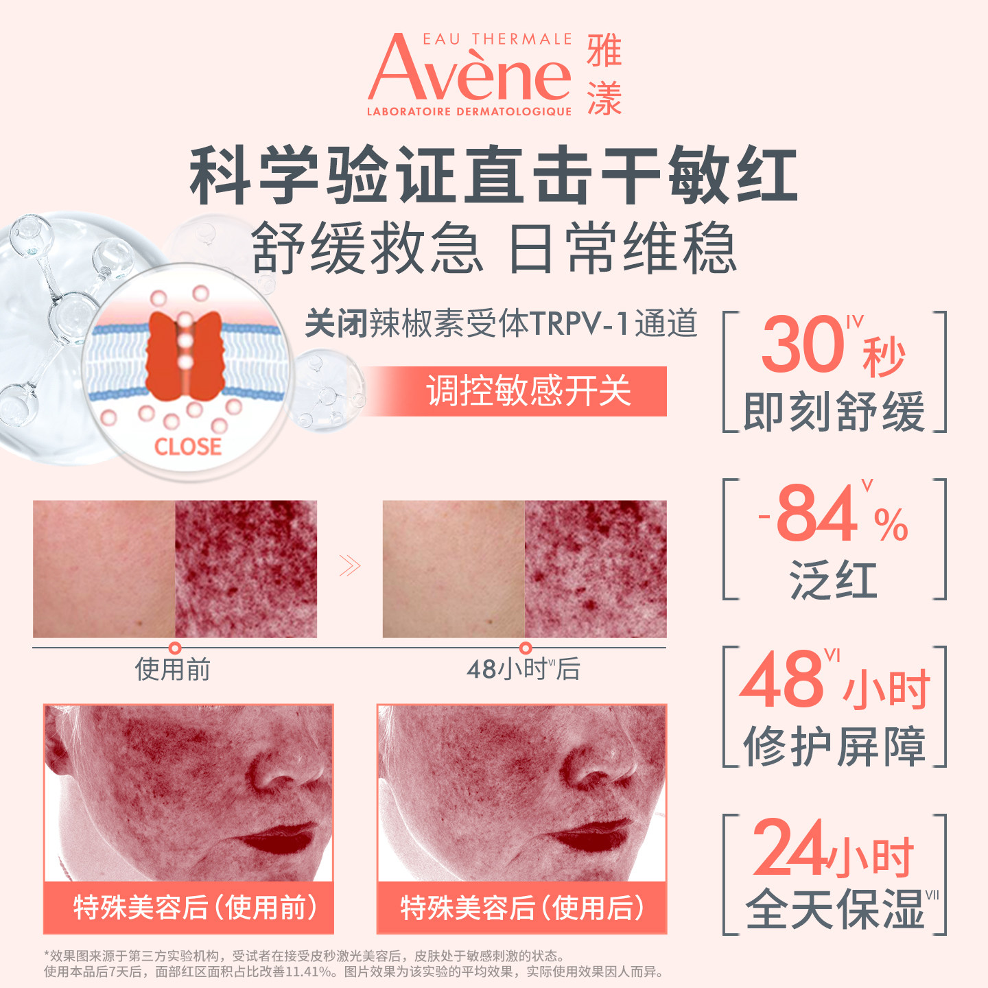 雅漾舒缓特护保湿乳50ml保湿维稳敏感肌修护滋润舒缓敏肌乳液面霜