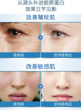 12瓶胶原蛋白线球紧致提拉提亮肤色淡化细纹改善肤质精华