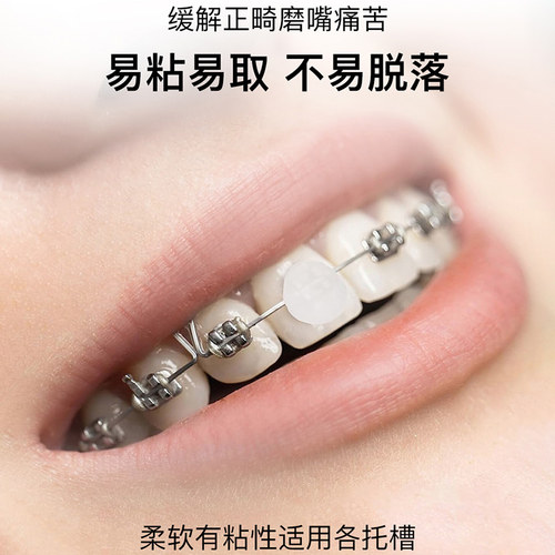 美国进口DenTek德泰克正畸保护蜡防磨嘴牙套蜡矫正期牙齿托槽专用 - 图1