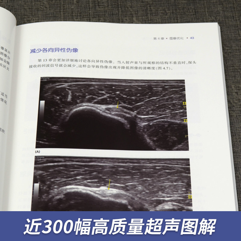 【官方直营】肌肉骨骼超声基础入门篇 超声基本理论及成像原理 仪器调节 超声物理学 多普勒成像 肌肉肌腱成像特点 超声引导下注射