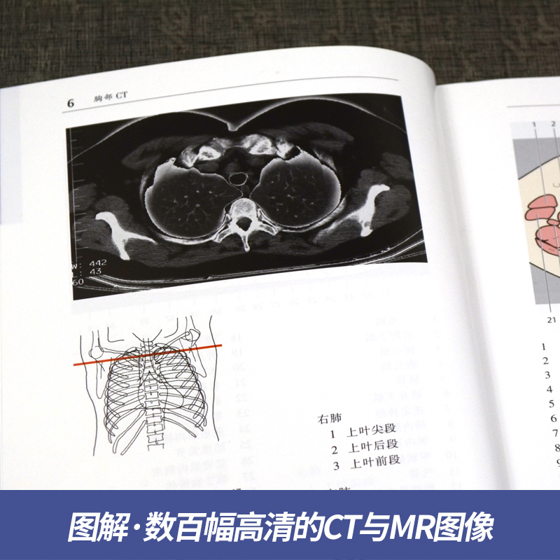 【官方直营】CT与MRI袖珍断层解剖图谱第2卷：胸、心、腹、盆、腔引进版影像医学人体解剖图谱彩色图谱影像断层解剖实用图谱-图2