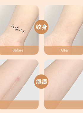 日本遮盖纹身贴疤痕超薄覆盖隐形神器肉色胎记伤疤防水自然遮瑕贴