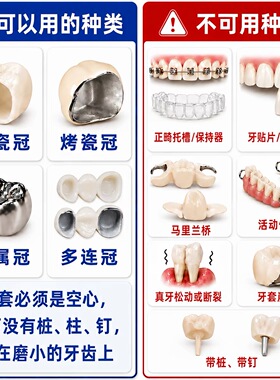 粘烤瓷牙强力专用胶水牙冠脱落假牙连桥瓷牙金属钢牙套脱落粘接剂