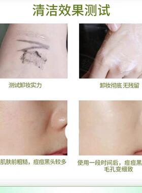 竹炭洗面奶深层清洁毛孔卸妆补水保湿控油祛痘淡化痘印去黑头粉刺