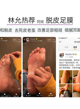 欧丽源手膜脚膜去死皮老茧足膜