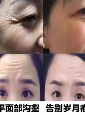 去抬头纹抗皱紧致六胜肽祛皱纹神器抗衰老面霜保湿补水男女护肤品