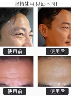 祛皱纹美白神器去除抬头纹男女提拉紧致六胜肽抗皱美白面霜抗衰老