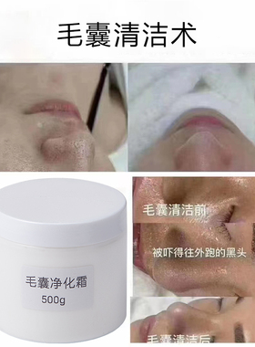 美容院专用毛囊黑头净化霜