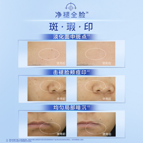 【NO.1淡斑精华】妮维雅630精华淡斑美白焕亮精华液抗氧化官方 - 图3