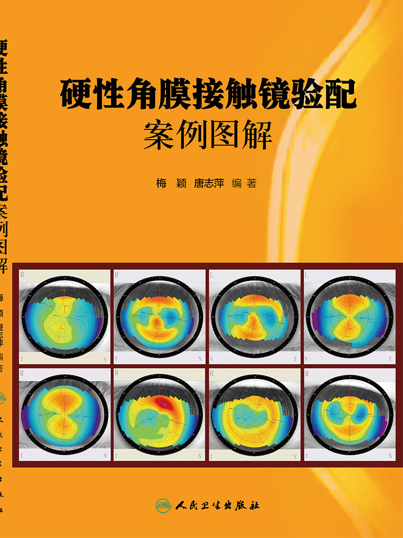 正版硬性角膜接触镜验配案例图解梅颖临床实用医学书籍人民卫生出版社-图0