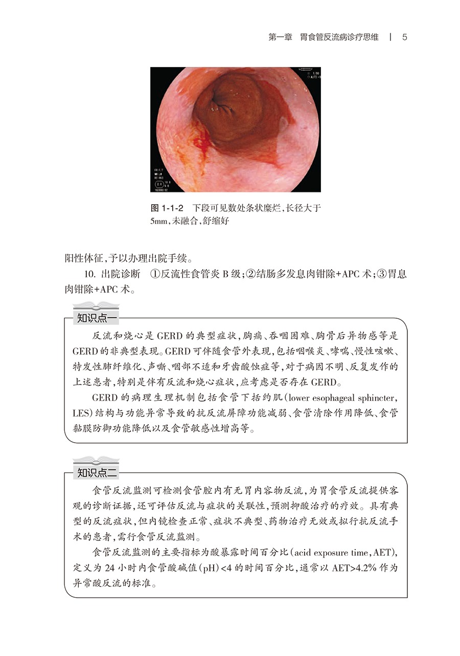 消化系统常见疾病诊疗思维 董卫国 于红刚主编 消化道肝胆胰常见疾病临床诊疗流程 典型病例诊治思路 人民卫生出版社9787117346504 - 图3