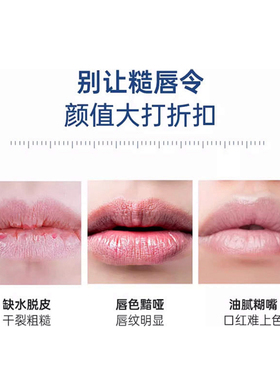 vaseline原味润唇膏10g3支加强版