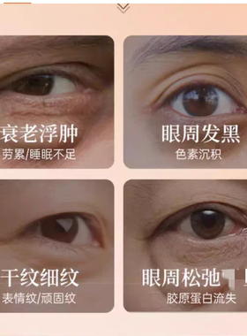 阿育吠陀岩兰草眼部精油滚珠按摩型印度正品细纹眼纹黑眼圈鱼尾纹