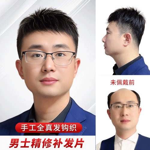 假发男士真人发丝头顶脱发男生手织补发块中年男式毛寸无痕补发片 - 图0