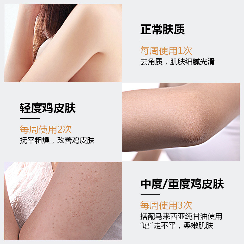 磨砂膏全身祛去除鸡皮肤疙瘩毛囊乳 瑜然美红桃客身体磨砂