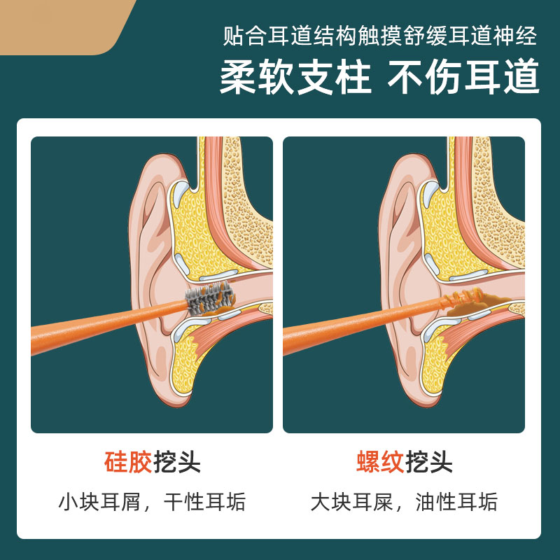 掏耳勺挖耳勺套装采耳工具便携挖耳朵神器扒耳屎不锈钢日美同款-图1
