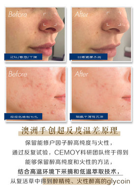 澳洲cemoy超级复活面霜补水修复