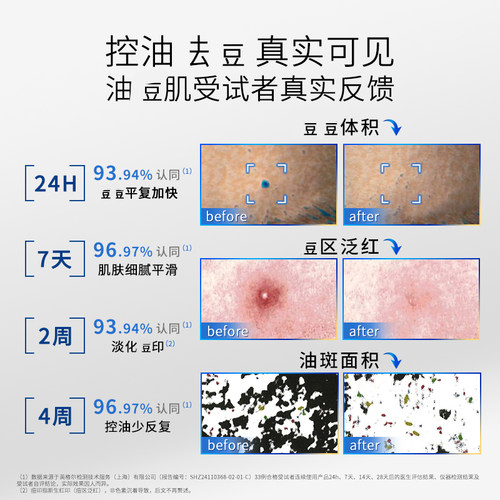 敷尔佳清痘净肤次抛精华液杏仁酸战痘棒胶原蛋白控油保湿温和面部 - 图1