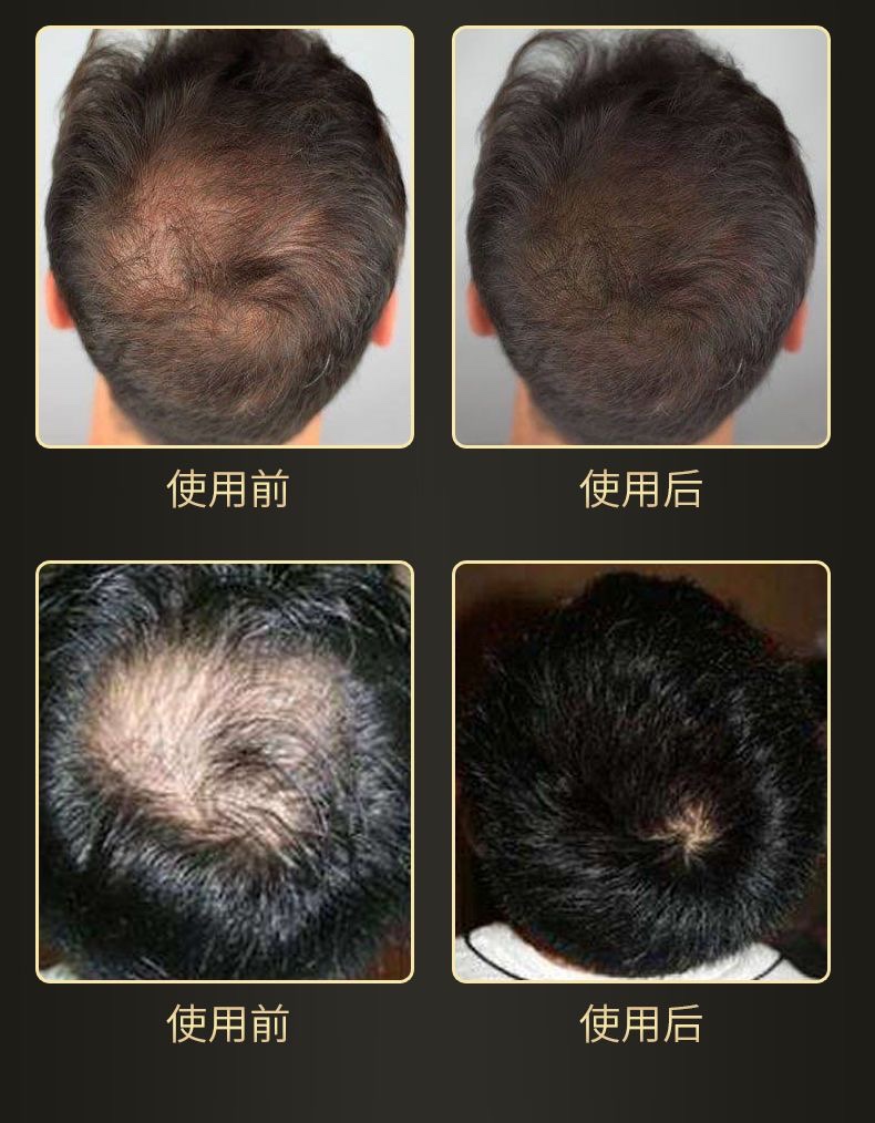 头发纤维发际线增发密发遮发神器增发纤维粉头顶补发假发粉 - 图2