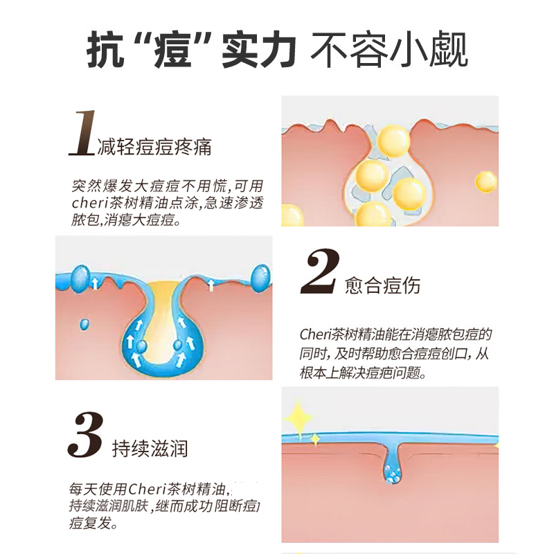 Cheri澳洲茶树单方精油面部植物祛痘脸部淡化痘印天然控油30ml - 图0