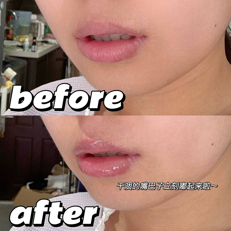 韩国Bringgreen芭兰歌林润唇膏玻尿酸唇部精华滋润保湿补水防干裂 - 图2