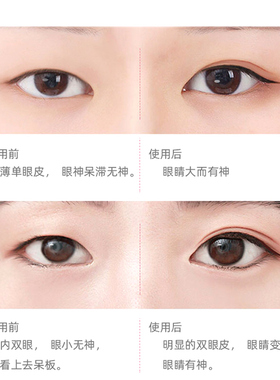 LuckyTrendy无痕双眼皮贴
