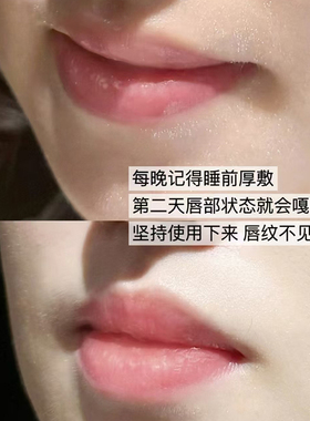 凡士林Vaseline经典晶冻润唇膏