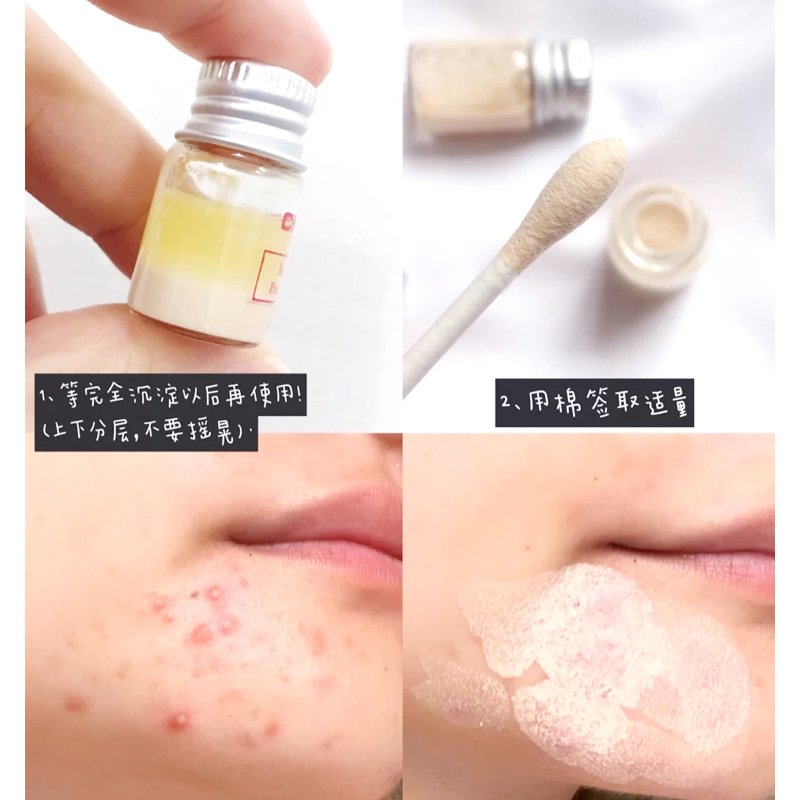 稀拉克儿痘痘精华液去闭口粉刺祛痘水杨酸淡化修护痘印痘坑小粉瓶,淘宝优惠券,粉丝福利购,淘宝优惠卷