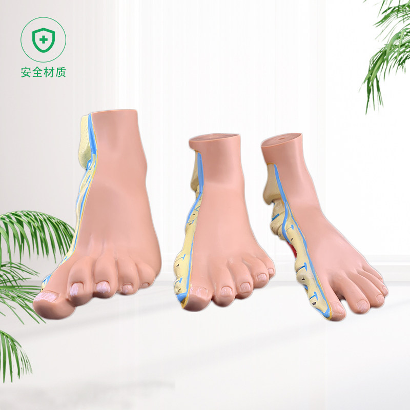 正常足弓形足高弓足模型脚关节模型爪形足脚部模型解剖医院