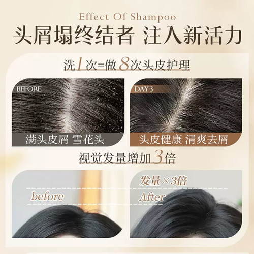 蒂花之秀洗发乳去屑止痒控油柔顺洗发水沐浴露护发素精油组合套装 - 图3