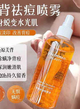苦参精华美背喷雾液除螨祛痘喷雾