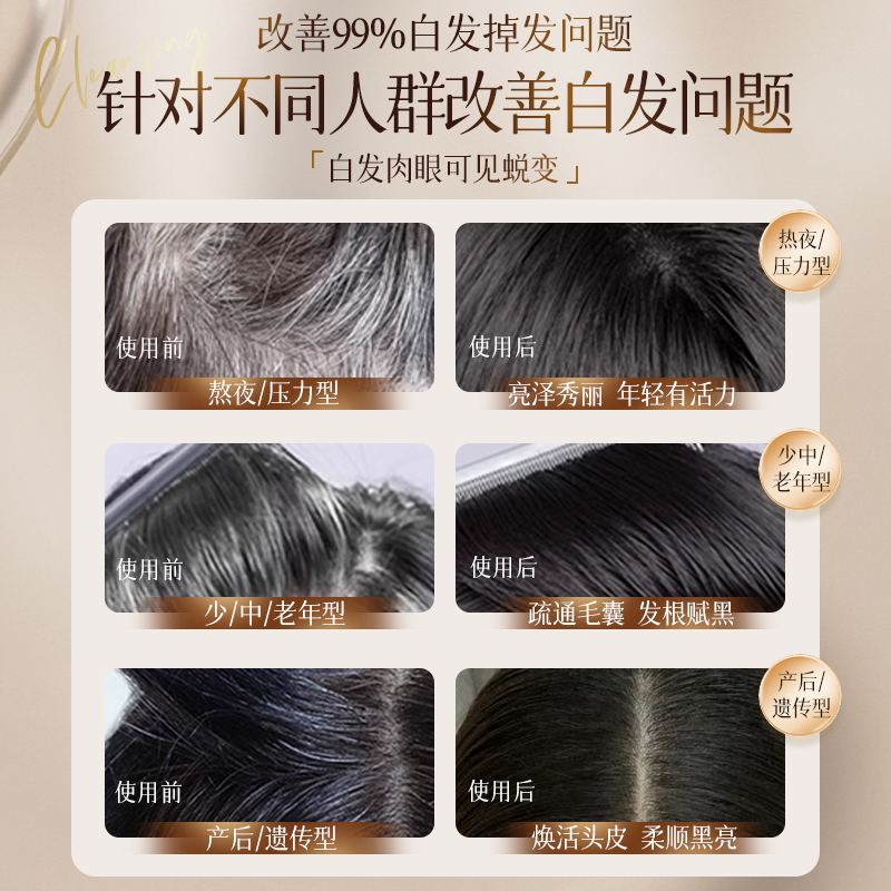何首乌洗发水养发去屑止痒控油蓬松变黑发纯植物神器男女品牌正品