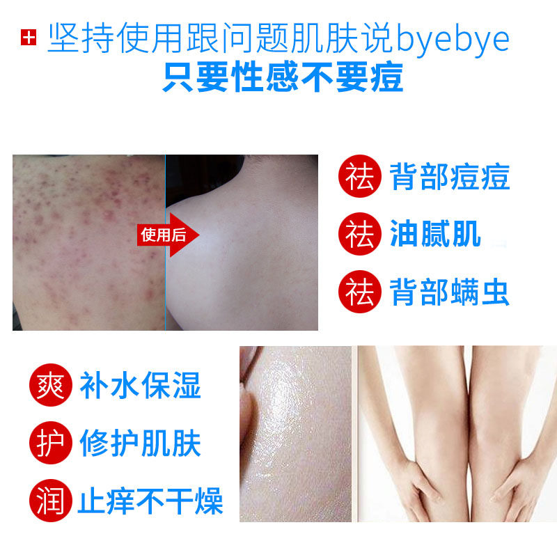 满婷背部祛痘除螨虫沐浴皂去背后胸前痘痘粉刺背上后背去螨虫香皂_虎窝淘