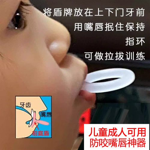 日本防止小孩咬下嘴唇神器儿童嘴凸口呼吸矫正戒咬嘴唇前庭盾矫正 - 图2
