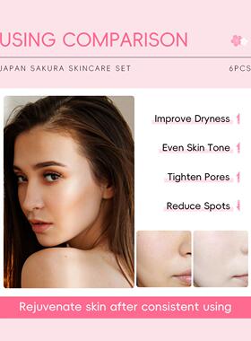 Six-piece Cherry Blossom Skincare Set  樱花护肤品6件套礼盒装