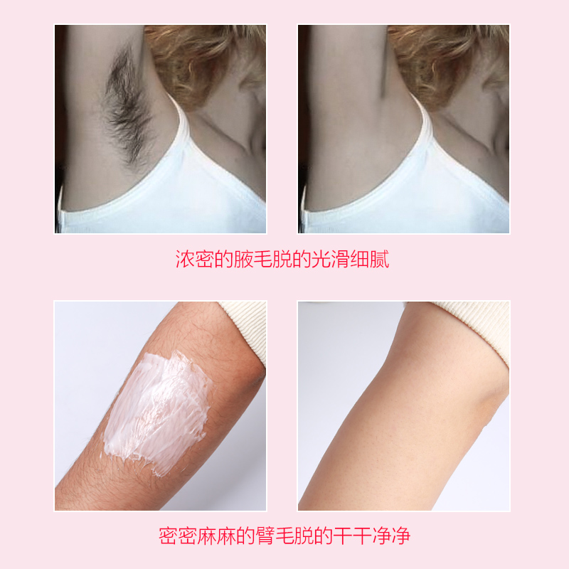 可孚医疗器械旗舰店日出倾城温和脱毛膏男女腋下全身非永久私处腿毛胡子胡须脸部专用0