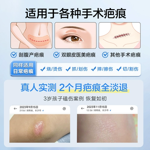 可孚 Гель, восстанавливающий послеродовой бондаж, детский крем от шрамов