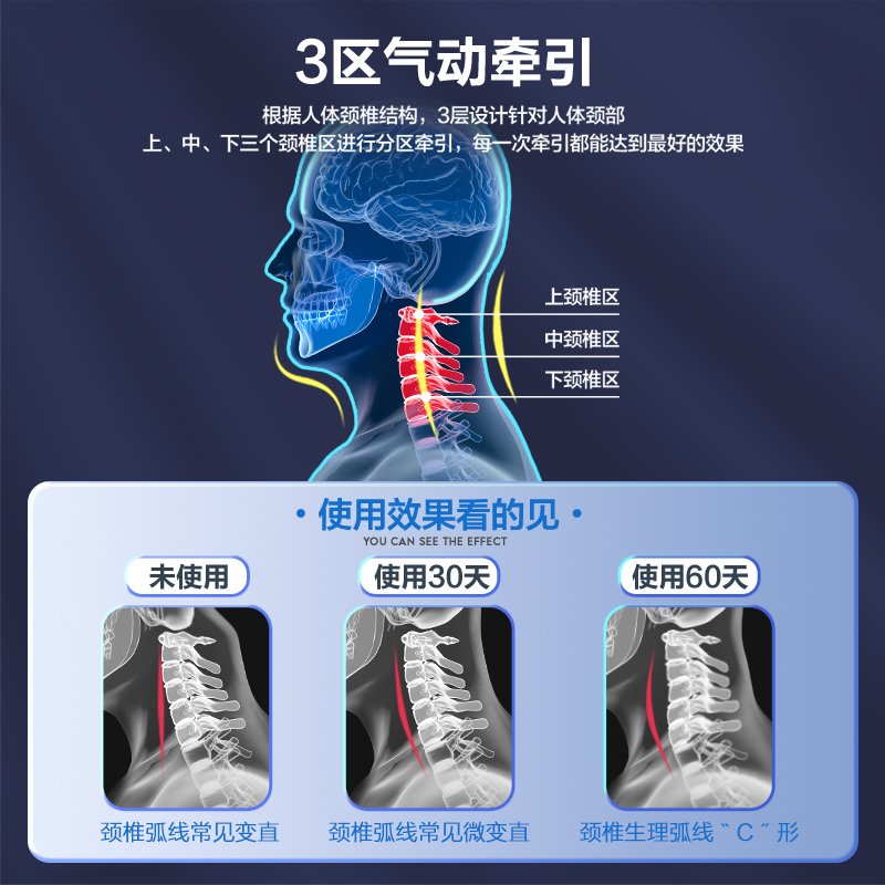 颈椎牵引器脖子病前倾家用充气式颈托医用护颈拉伸非矫正器劲脖套 - 图1