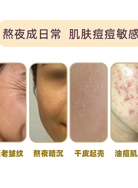 厚脸皮面膜层孔菌舒缓面膜白桦树汁二裂酵母海茴香玻色因小球藻等