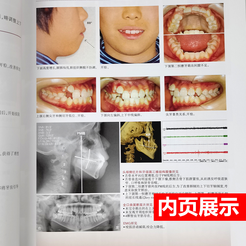 正版 Muscle Wins正畸临床矫治疑难问题及病例解析矫正齿科临床翻译近藤悦子著当代口腔科学牙齿正畸学矫治书籍入门专科教程人卫版 - 图2