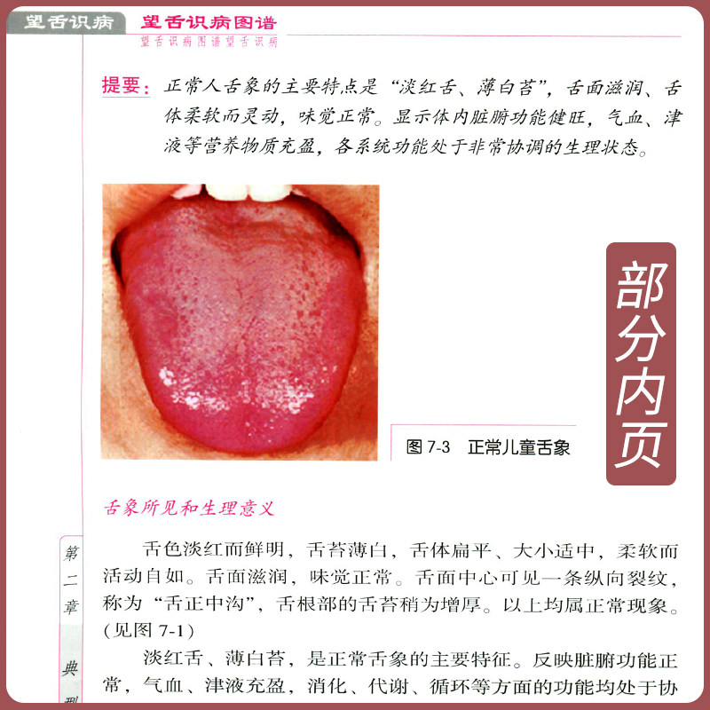 正版中医舌诊3本望舌识病图谱+图解舌诊断病+中医舌诊图解图谱罗大伦舌像舌苔舌象辨析临床病症望舌诊病方剂舌诊入门基础自学书籍_虎窝淘